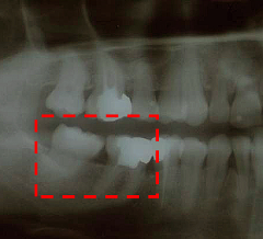bild2